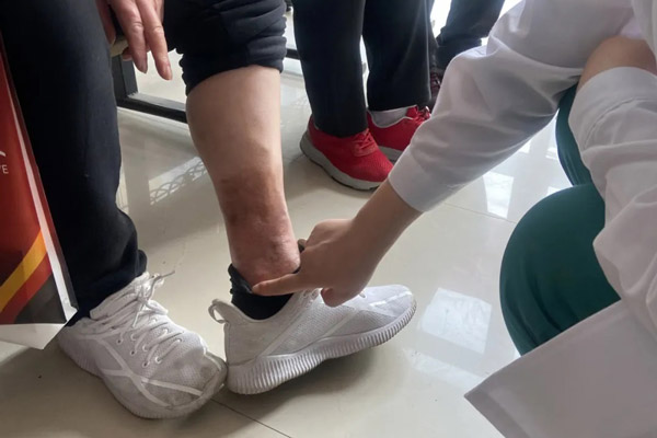 全方位诊疗服务，沈阳下肢静脉曲张专科医院帮助您恢复腿部美丽与健康，重拾自信人生。